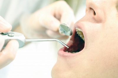 歯の治療１.jpg