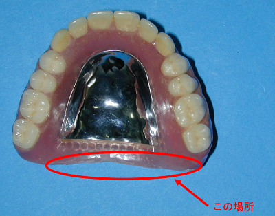 義歯画像2.png