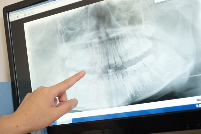 Examination of orthodontic treatment202109.jpg