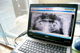 tooth treatment plan image.jpg
