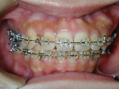 院長Blog｜常滑市の矯正歯科 歯科/久野歯科医院 成人矯正等に対応